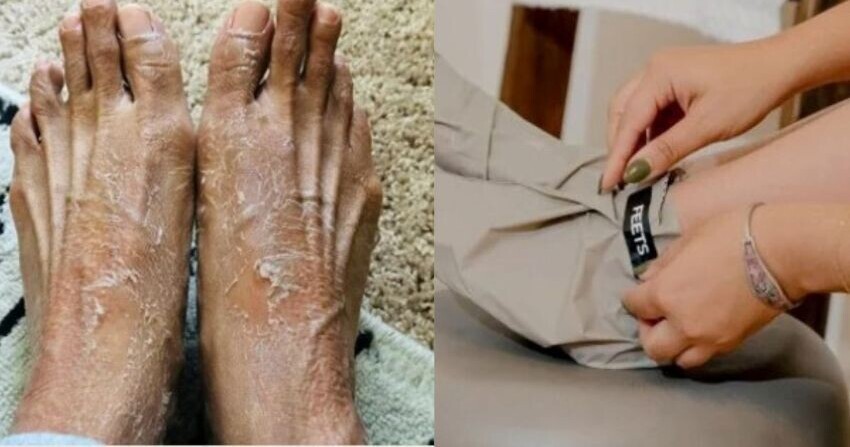 The Foot Peel Mask Review